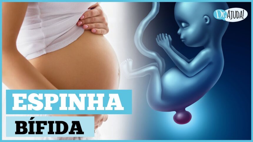 O que é e como prevenir a mielomeningocele?