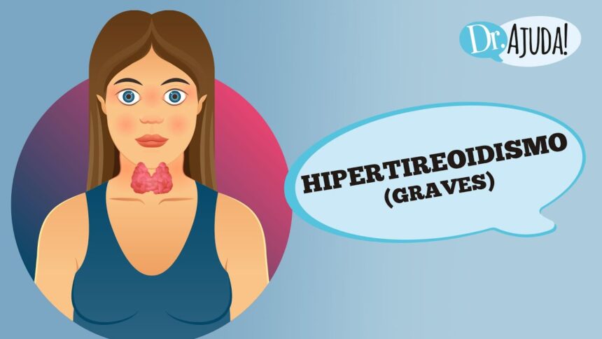 Hipertireoidismo, o que é?