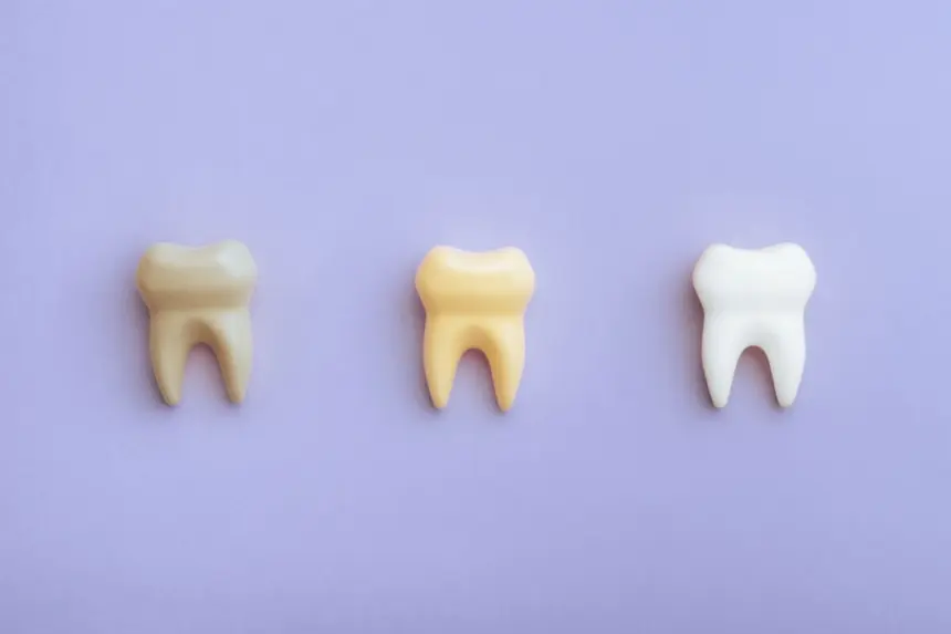 5 mitos e verdades sobre manchas nos dentes 5 mitos e verdades sobre manchas nos dentes