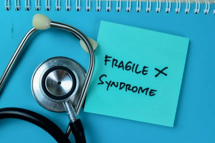 Síndrome do X Frágil: conheça as causas e os sintomas Síndrome do X Frágil: conheça as causas e os sintomas