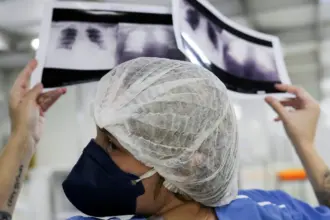 Brasil deve ter 781 mil novos casos de câncer por ano até 2028