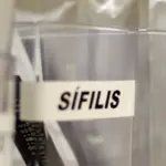 Centro de SP tem testagem grátis de HIV, hepatite, síflis e gonorreia