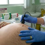 Sífilis em gestantes dispara em Goiás e rede pública reforça testes rápidos na capital